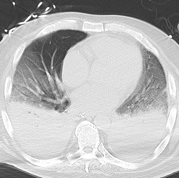 case-week-1-img-6