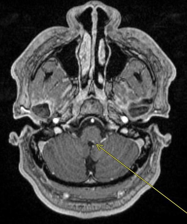 neuro_1.jpg