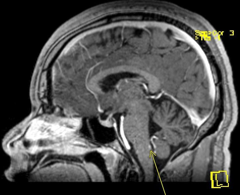 neuro_2.jpg